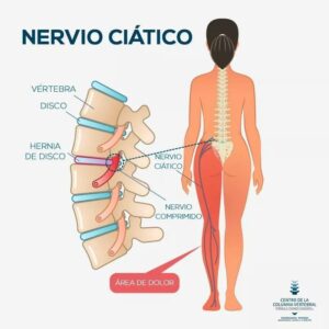 Centro de la Columna Vertebral