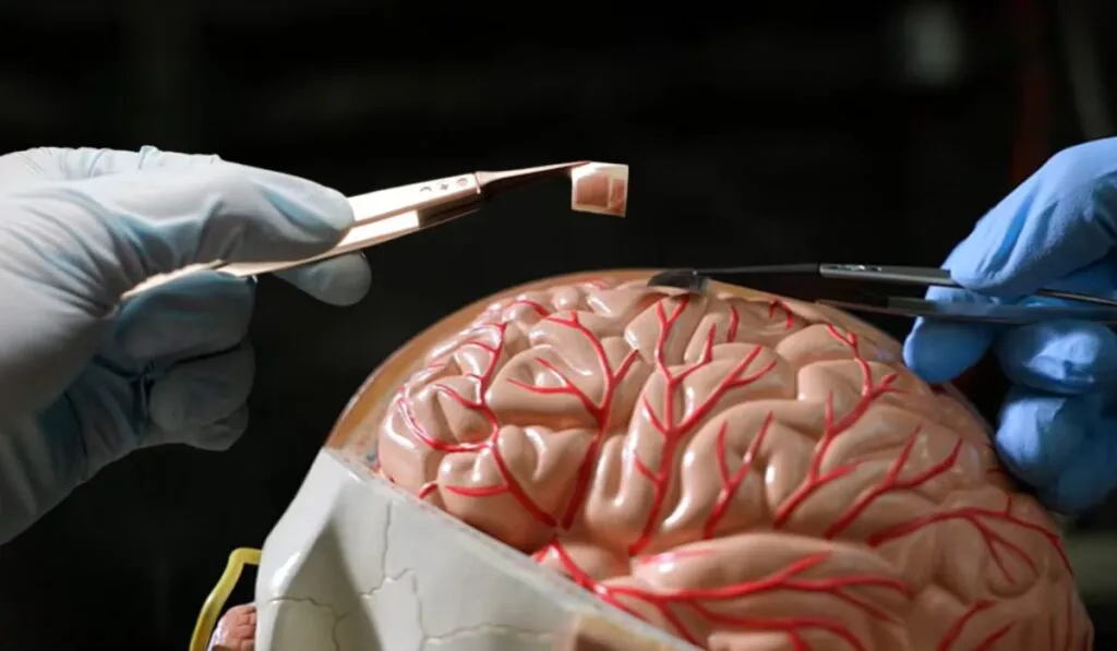 Un implante más pequeño que una moneda podría dejar atrás a Neuralink