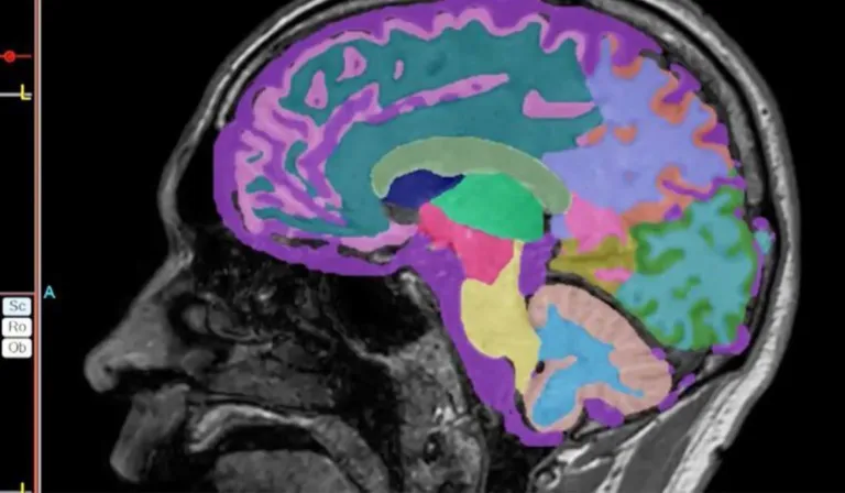 Científicos del IPN descubren el “punto cero” del alzhéimer en el cerebro