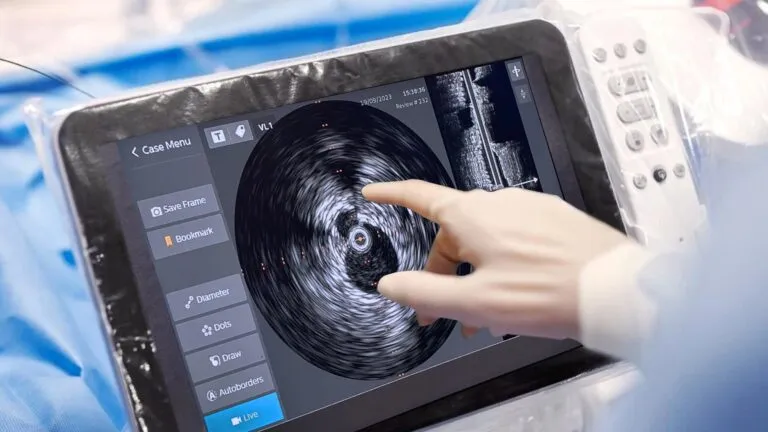 Ultrasonido intravascular para diagnóstico cardiovascular de alta precisión.
