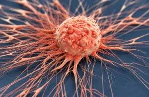 Paclitaxel provoca una respuesta mecánica inesperada en células tumorales durante una investigación sobre resistencia