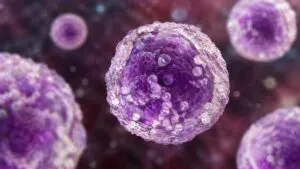Linfoma y nuevos tratamientos innovadores para pacientes