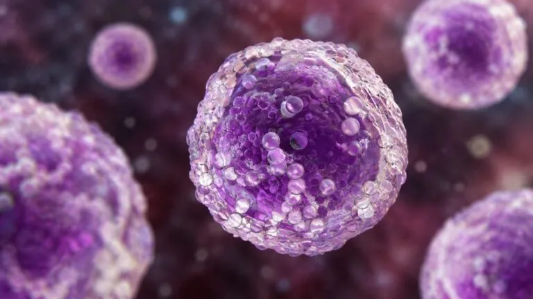 Linfoma y nuevos tratamientos innovadores para pacientes