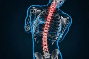 Implante para escoliosis desarrollado para corregir la columna adolescente mientras busca conservar su movilidad natural.