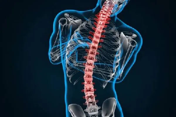 Implante para escoliosis desarrollado para corregir la columna adolescente mientras busca conservar su movilidad natural.